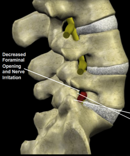 Stacks Image 3