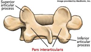 Medtronic_anatomy_pars_300_172_80